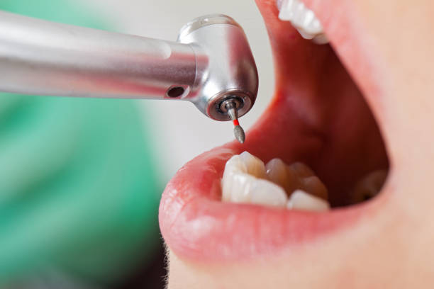 Best Pediatric Emergency Dentist in Zeigler, IL